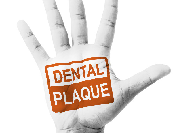 placa_dental_clinica_mallorca_dentista